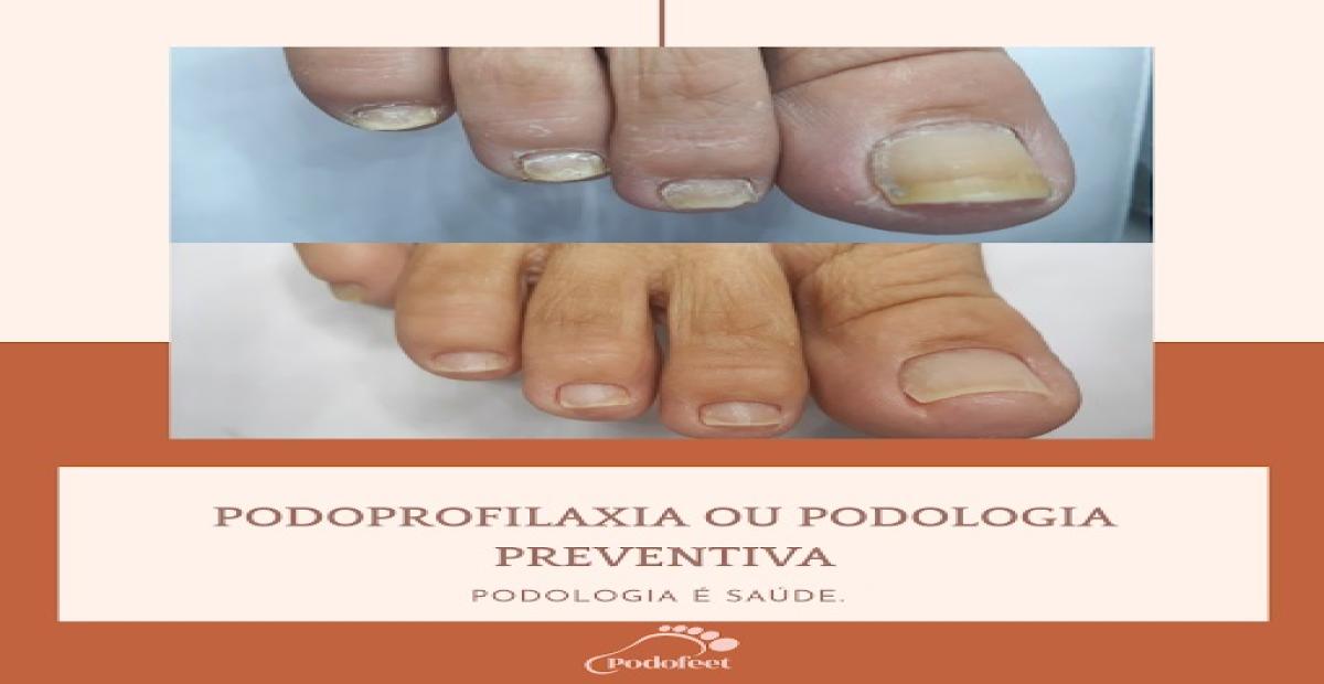 Podofeet CG - Planos de Saúde PJ